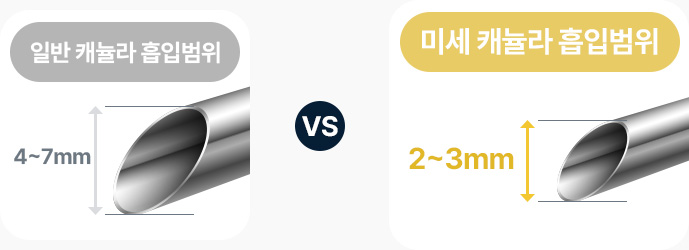 이중턱 지방흡입 일반캐뉼라 흡입범위 4mm에서 7mm 미세캐뉼라 흡입범위 2mm에서 3mm