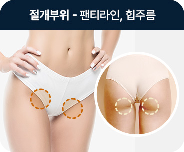 바디 지방흡입 절개부위 팬티라인 힙주름