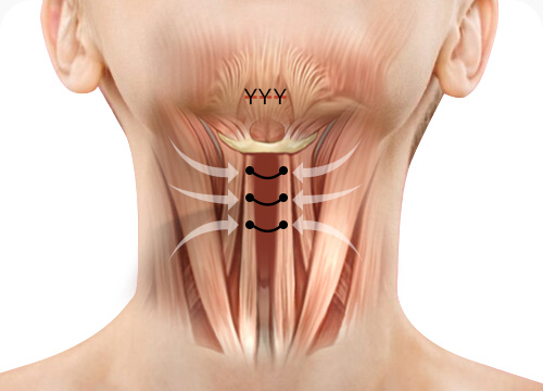 이중턱 근육묶기