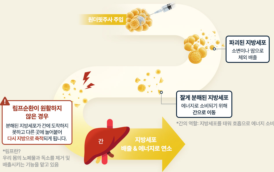원더핏주사(얼굴) 지방분해주사 파괴된 지방세포 소변 땀으로 배출 잘게 분해된 지방세포 간으로 이동 림프순환이 원활하지 않으면 지방으로 축적 간에서 지방셒포 배출 에너지로 연소