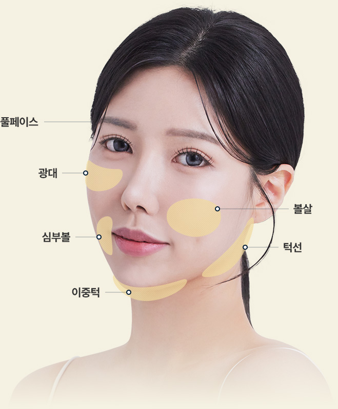 원더핏주사(얼굴) 지방분해주사 풀페이스 광대 심부볼 이중턱 볼살 턱선