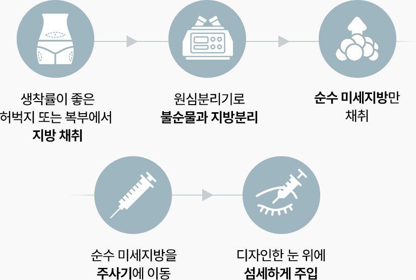 눈위지방이식 방법 지방채취 지방분리 순수 미세지방 섬세하게 주입