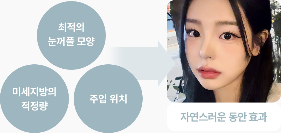 동안효과 최적의 눈꺼풀 모양 미세지방 적정량 주입위치