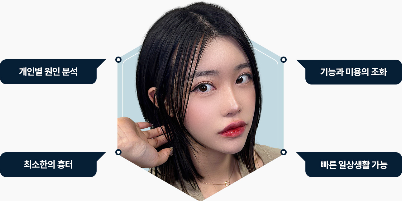 눈꺼풀지방제거 개인별 원인분석 최소흉터 빠른 일상생활