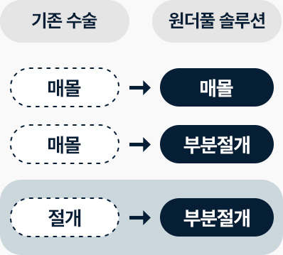 기존 수술 매몰 원더풀 솔루션 매몰 부분절개 기존수술 절개 원더풀 솔루션 부분절개