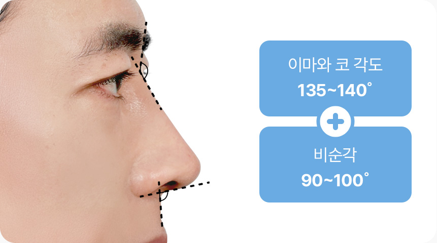 이마와 코 각도 135도 140도 비순각 90도 100도