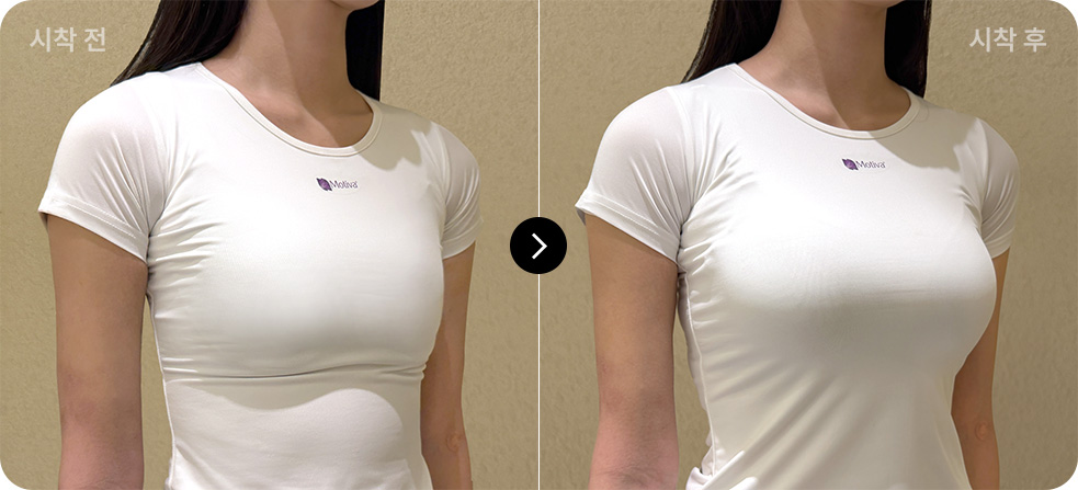 시착가능 보형물 가슴확대