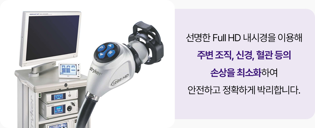 full HD 내시경 주변 조직 신경 혈관 손상 최소화 안전하고 정확한 박리