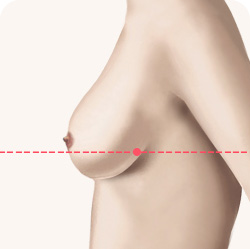 가슴거상 유방하수 등급 정상