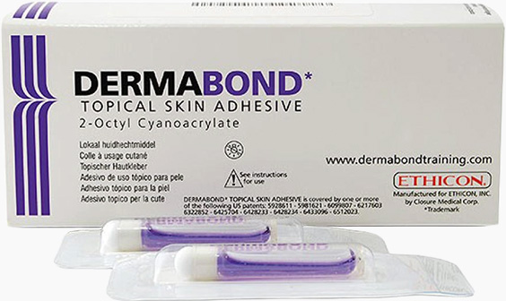 더마본드 흉터최소화 가슴거상 실밥제거 없음