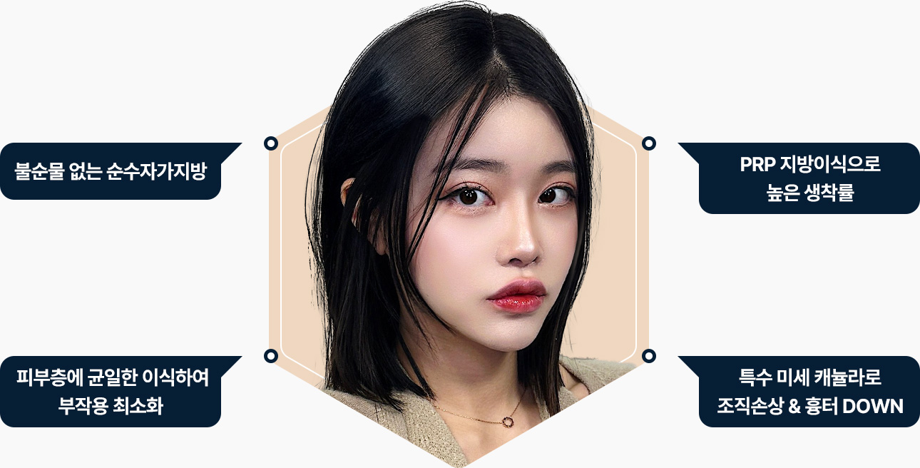 얼굴지방이식 순수자가지방 PRP 지방이식 높은 생착률 피부층에 균일한 이식 부작용 최소화 특수 미세 캐뉼라 조직손상 흉터 최소화
