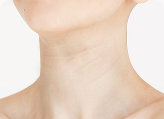 원더풀 목거상 연한 가로주름 선천적으로 생기는 주름