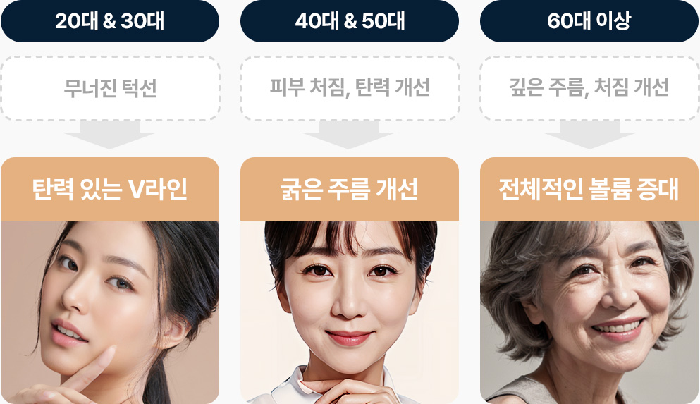 실리프팅 연령대별 효과 20대 30대 무너진 턱석 탄력있는 V라인 40대 50대 피부처짐 탄력 개선 굵은 주름개선 60대 이상 깊은 주름 처짐개선 전체적인 볼륨증대