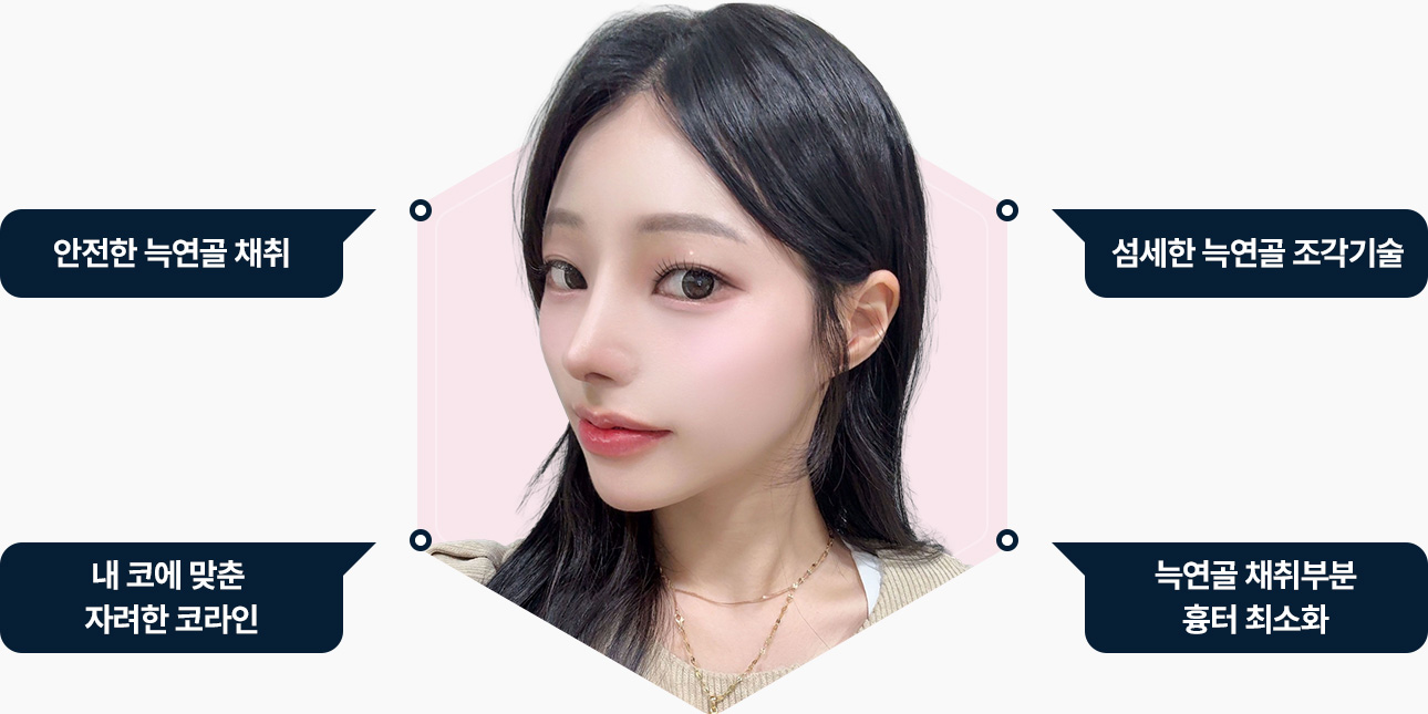 자가늑 코성형 안전한 늑연골 채취 섬새한 늑연골 조각 자려한 코라인 흉터최소화