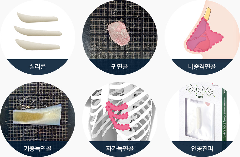 코성형 재료 실리콘 귀연골 비중격연골 기증늑연골 자가늑연골 인공진피