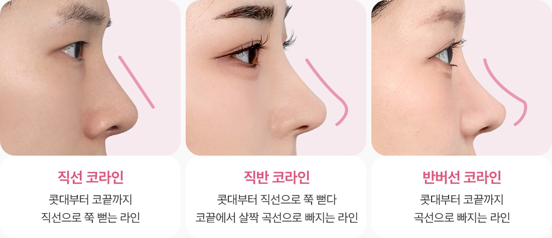 직선코라인 직반코라인 반버선코라인