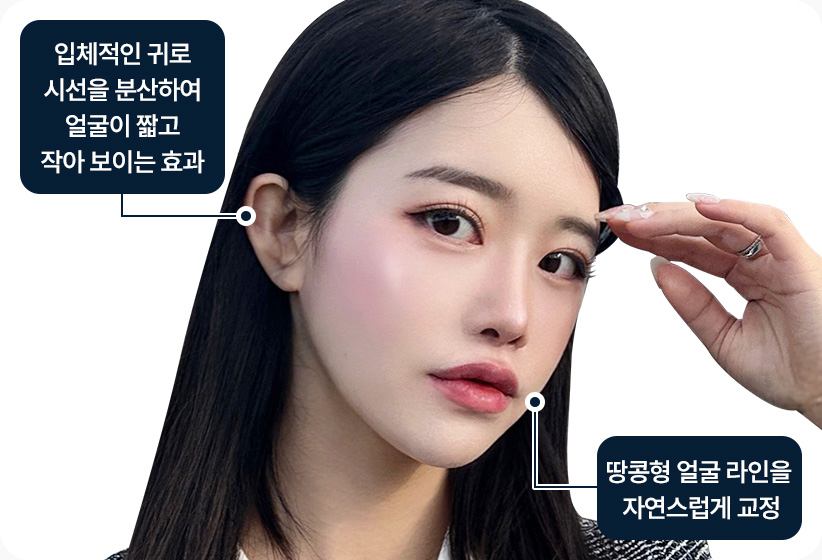 원더풀 귀필러 입체적인 귀로 시선을 분산하여 얼굴이 짧고 작아 보이는 효과 땅콩형 얼굴 라인을 자연스럽게 교정