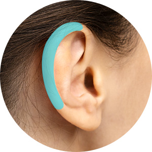 귓바퀴 교정