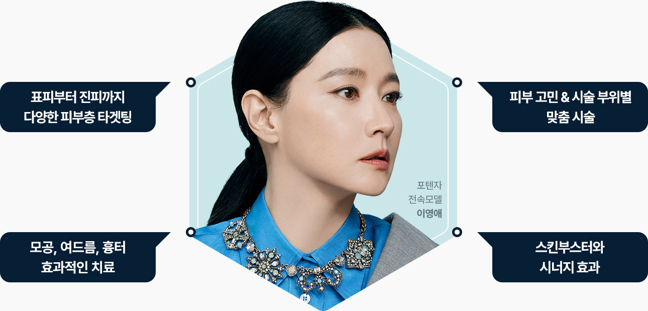 포텐자 표피 진피 다양한 피부층 타겟팅 피부고민 시술부위별 맞춤시술 모공 여드름 흉터 치료 스킨부스터 시너지효과