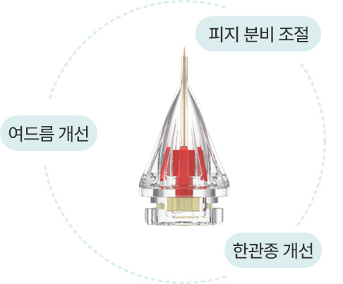 포텐자 스킨 침습형 핸드피스 ONE니들팁 피지분비조절 결절성 여드름개선 한관종개선