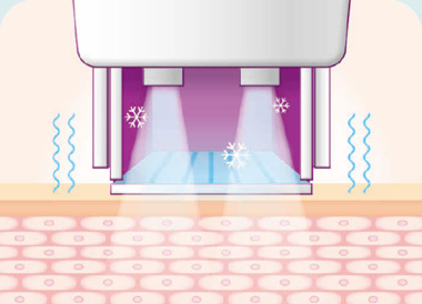 써마지FLX 시술방법 진동 쿨링 기능 피부 보호