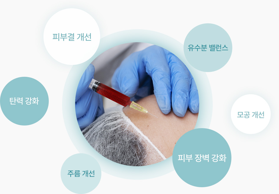 원더풀 줄기세포 피부주사 피부결개선 유수분밸런스 모공개선 피부장벽강화 주름개선 탄력강화