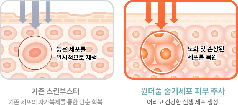 원더풀 줄기세포 기존 스킨부스터 단순회복 줄기세포 피부주사 건강한 신생세포 생성