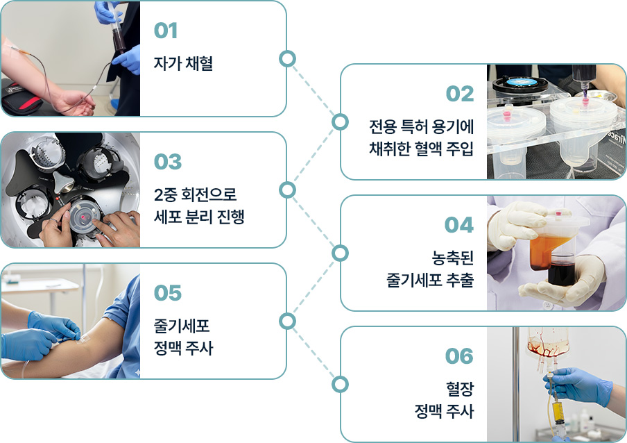 원더풀 줄기세포 자가채혈 전용용기에 채취한 혈액주입 2중회전으로 세포분리 농축된 줄기세포 추출 줄기세포정맥주사 혈장정맥주사