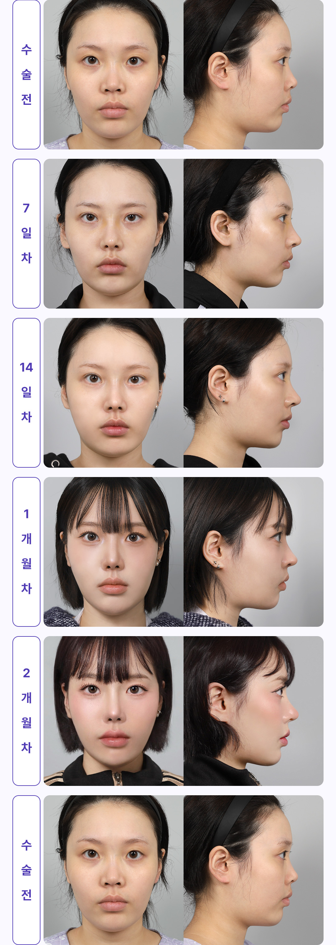 30일간 변화과정