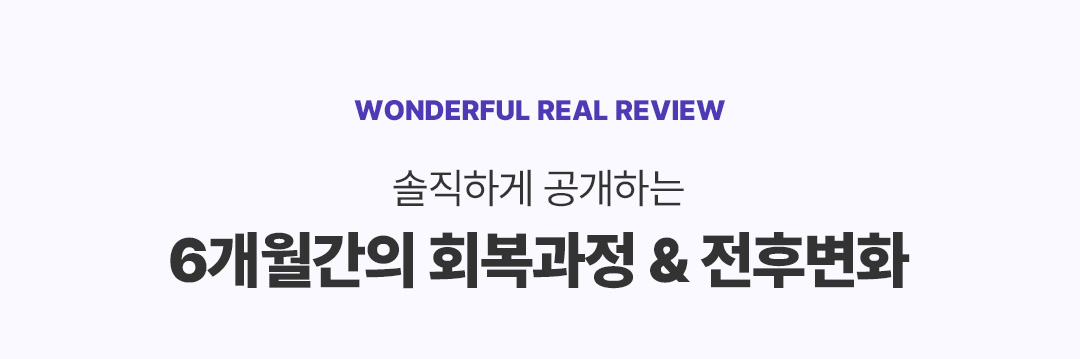 리얼후기 타이틀